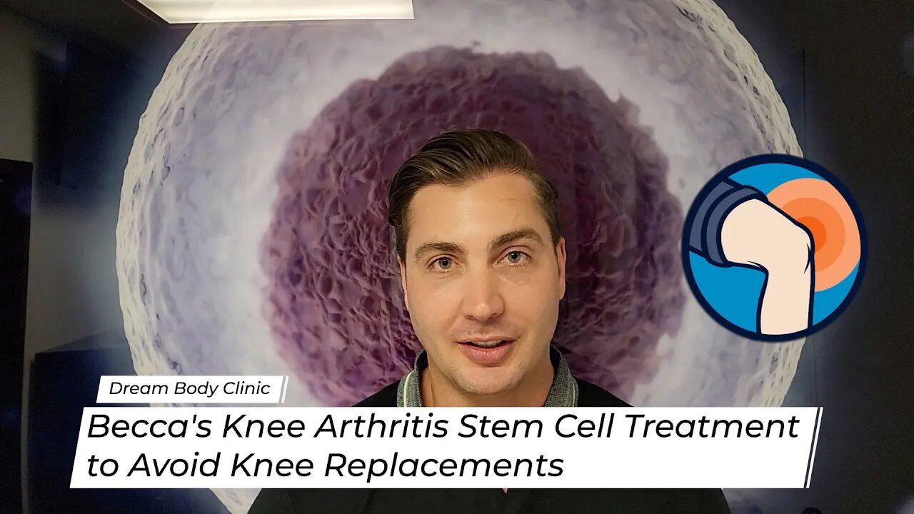 Becca's Knee Arthritis Stem Cell Treatment to Avoid Knee Replacements