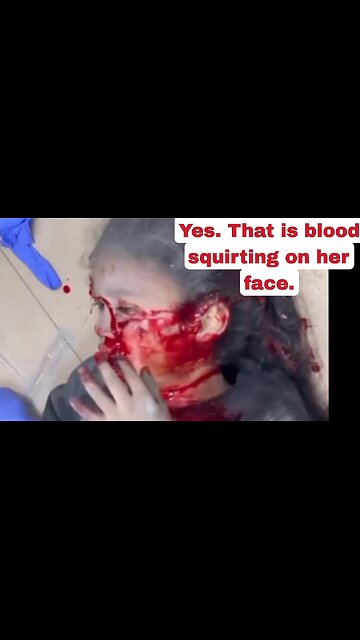 The Israeli Terrorist Regime Bombs Little Children... These Were Some of the Lucky Ones [HYM]