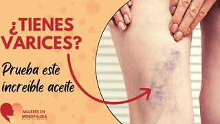 Aceite perfecto para ayudar con las varices | Mujeres en Menopausia