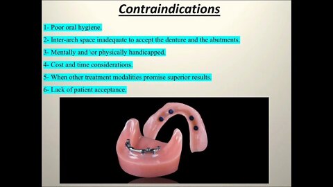 Prosthodontics L10 (Overdenture)