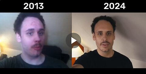 2013: Guy watches Bitcoin break $100. 2024: Guy watches it break $100k. Plus his acne cleared up!