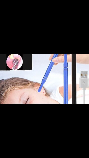 Multifunctional Ear Cleaning Endoscope with Mini HD Visual Camera