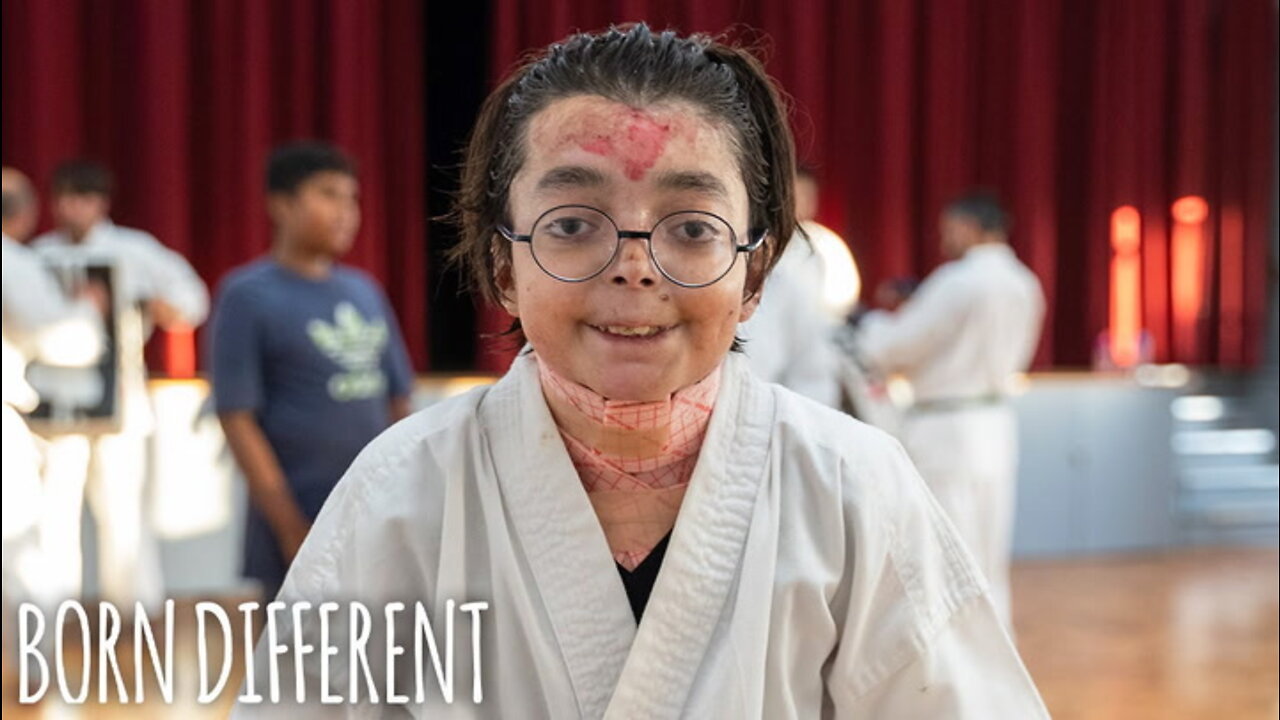 The 'Karate' Teen With Butterfly Skin | BORN DIFFERENT