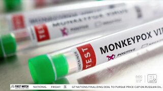 First Monkeypox case in Douglas County detected; authorities say 'not easily transmissible'
