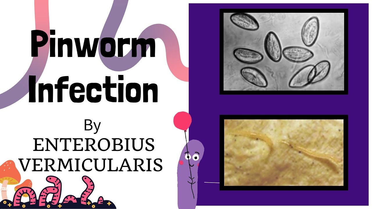 Pinworm Infection: Causes, Treatment, and Life Cycle | Intestinal Nematodes | Novice Medic