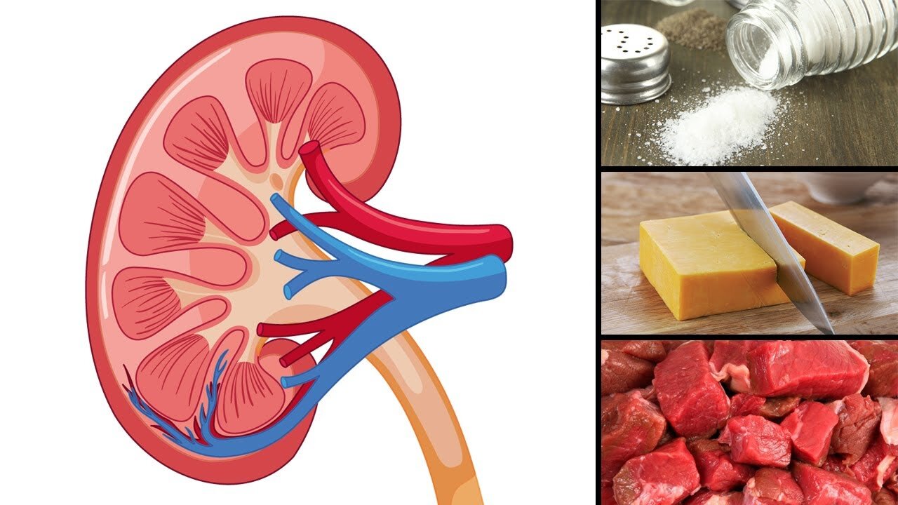 8 Foods that Are Actually Damaging Your Kidneys