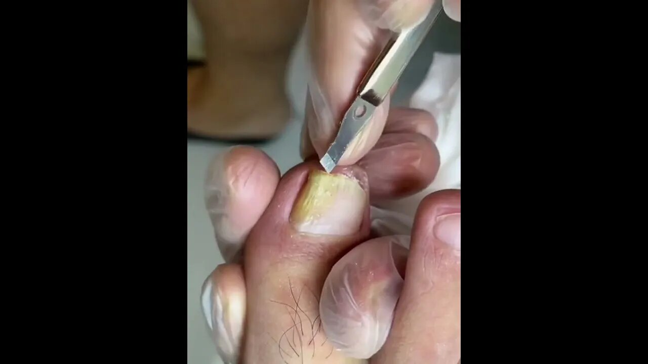 Nail cutting ASMR