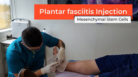 How to heal Plantar Fasciitis quickly