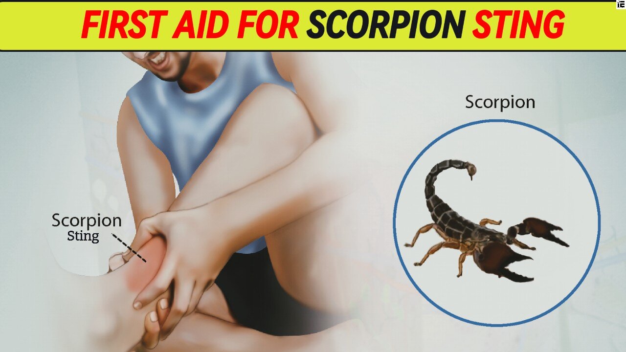 First Aid Tips for Scorpion Stings