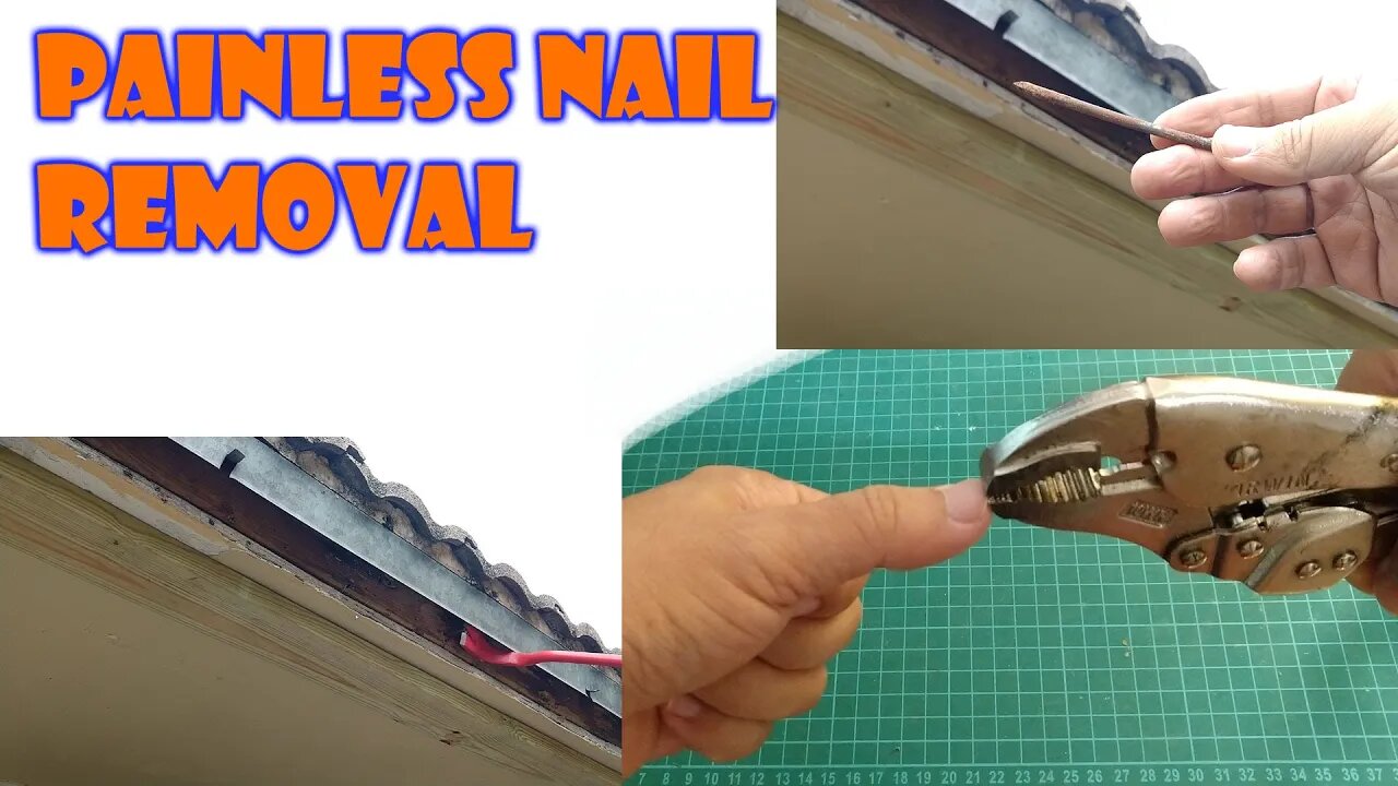 Common Nail removal