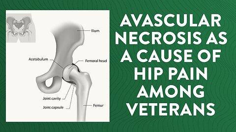 Avascular necrosis as a cause of hip pain among Veterans