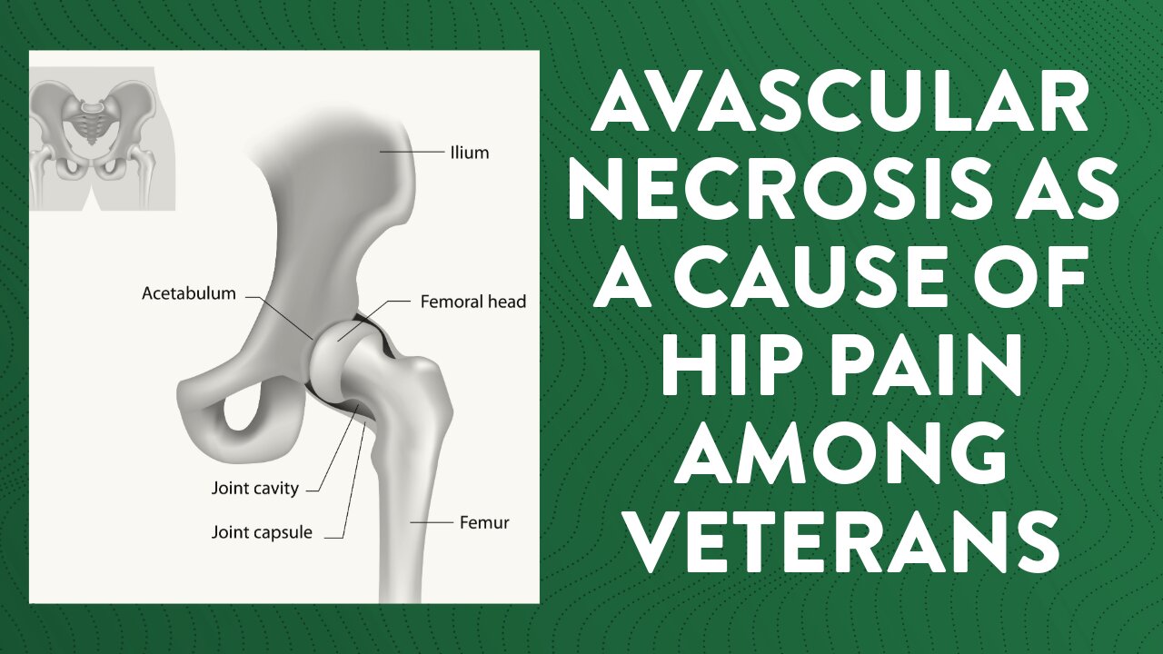 Avascular necrosis as a cause of hip pain among Veterans