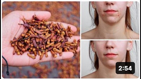 Start Consuming Cloves For Amazing Health Benefits