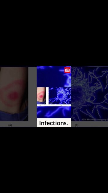 Possible causes of Female infertility. #shorts