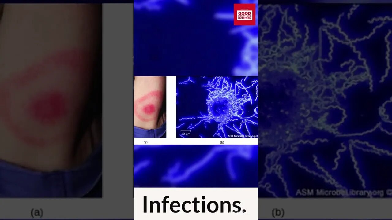 Possible causes of Female infertility. #shorts