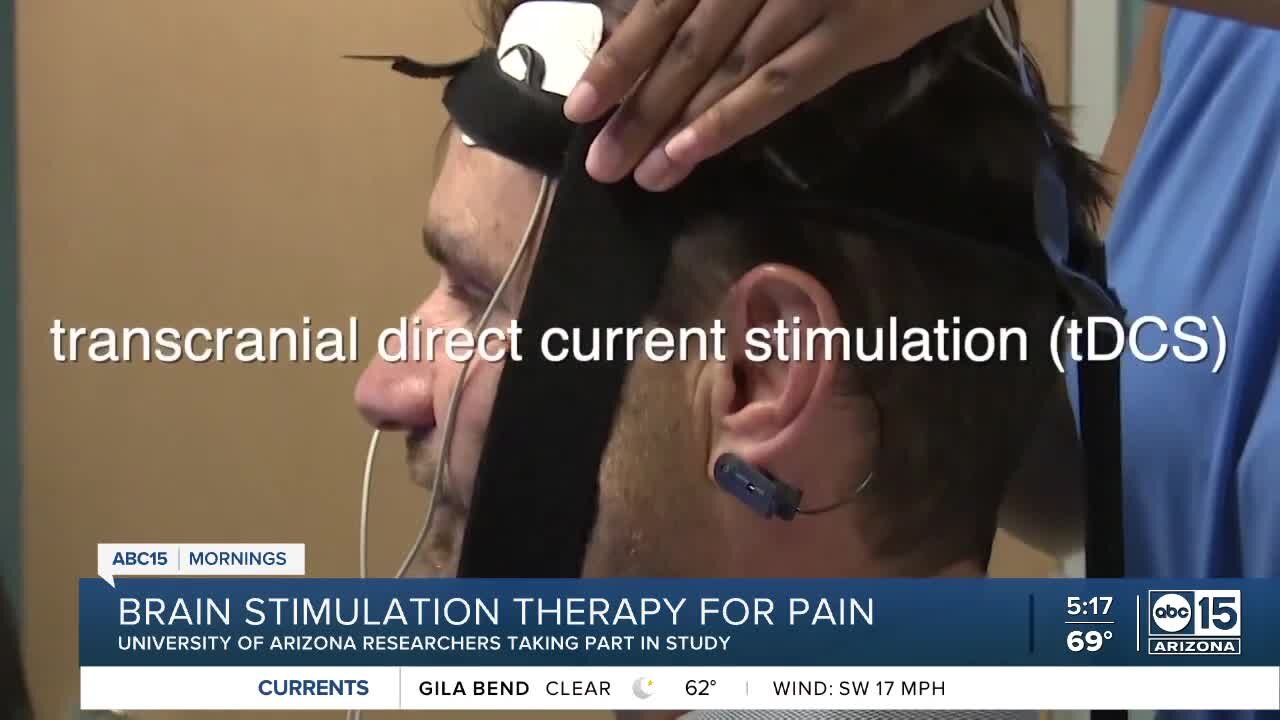 Brain stimulation therapy for pain