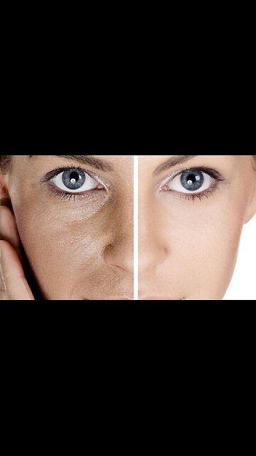 Top 3 Home Remedies for Clear Open Pores ✨🌿