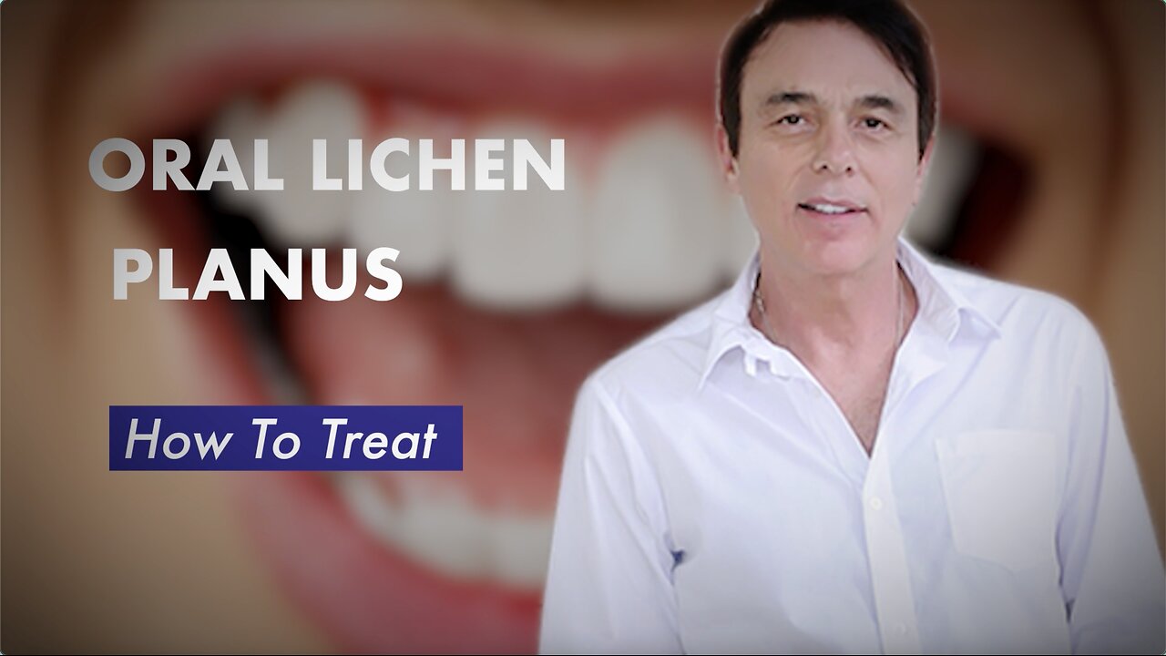 Oral Lichen Planus How To Treat