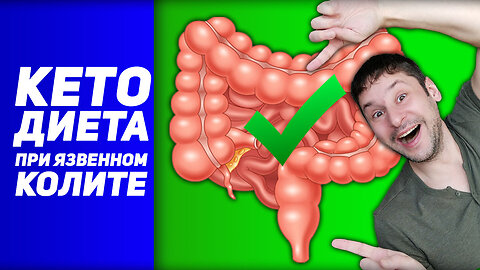 Кетогенная Диета при Язвенном Колите. ПОМОЖЕТ или НАВРЕДИТ?
