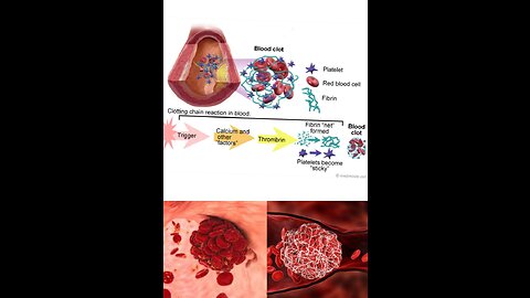 Platelets and blood clotting 🩸🩸