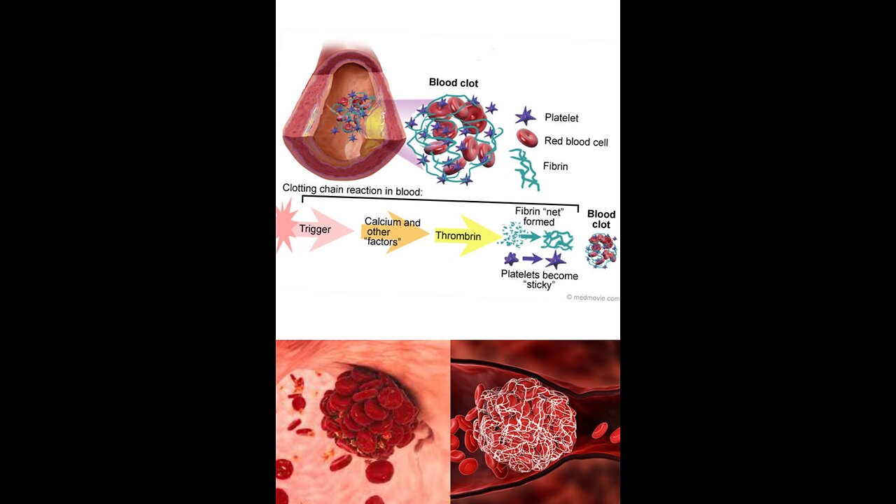 Platelets and blood clotting 🩸🩸