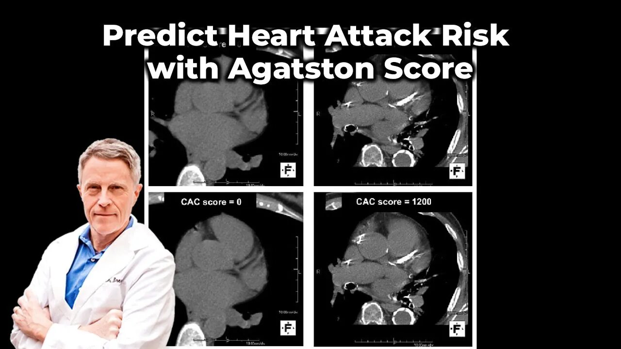 Predict Heart Attack Risk with Agatston Score