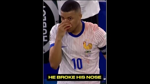 HE BROKE HIS NOSE MBAPPE