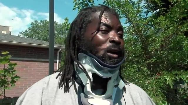 Injured man speaks out about bike safety after he and 4 others were struck by a car in Cleveland