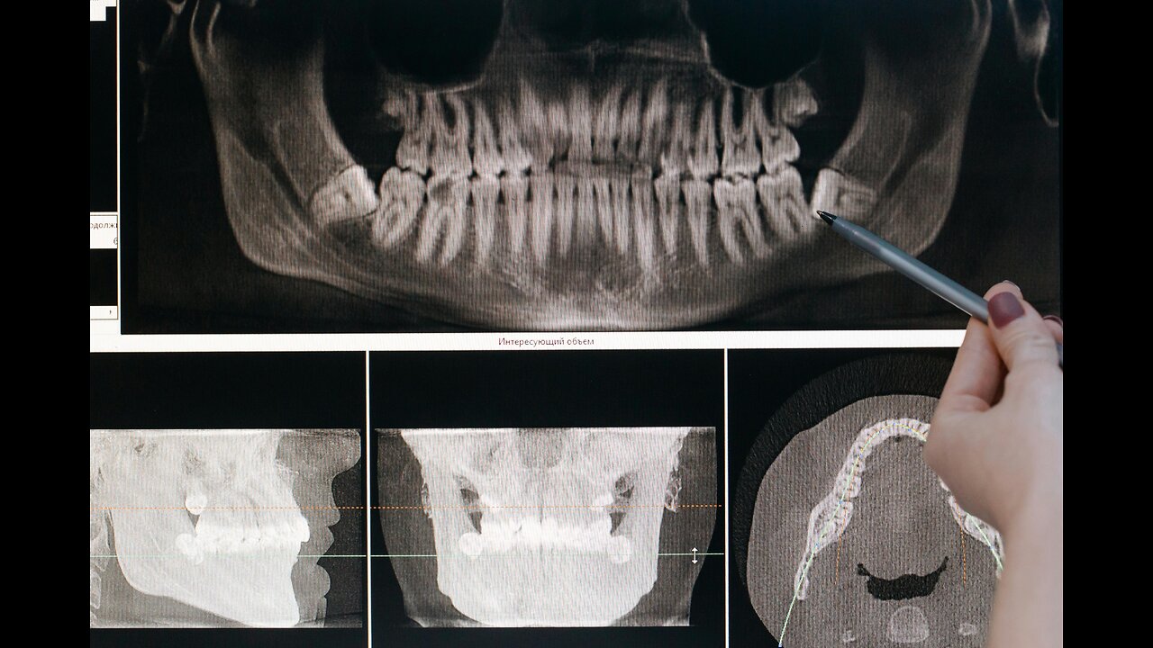 Safe and Comfortable Tooth Extraction Near You