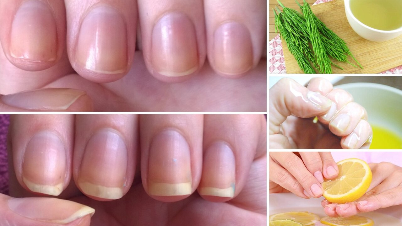 How to Grow Nails Faster & Stronger: 7 Best Home Remedies