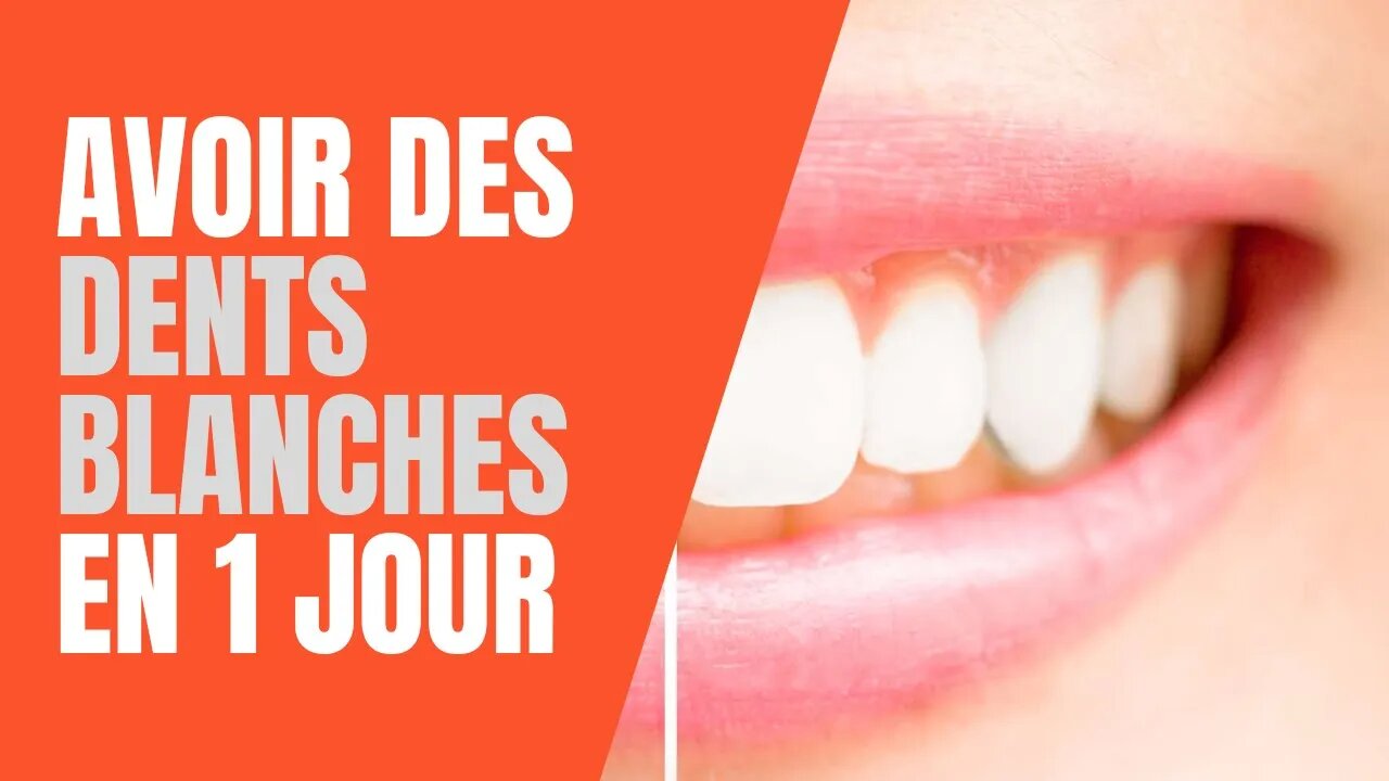 Comment avoir des dents blanches en 1 jour