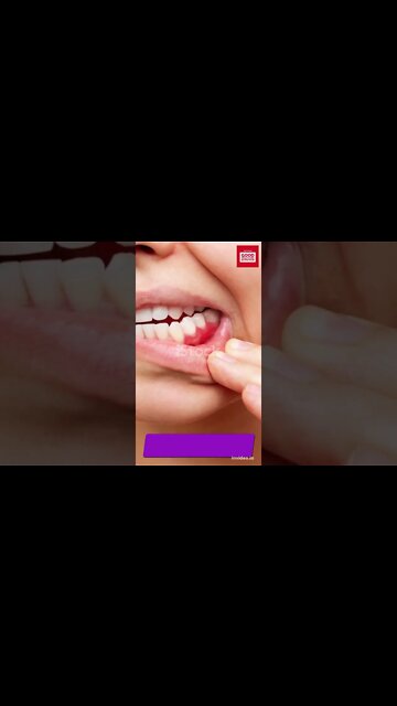 Benefits of chamomile tea #shorts