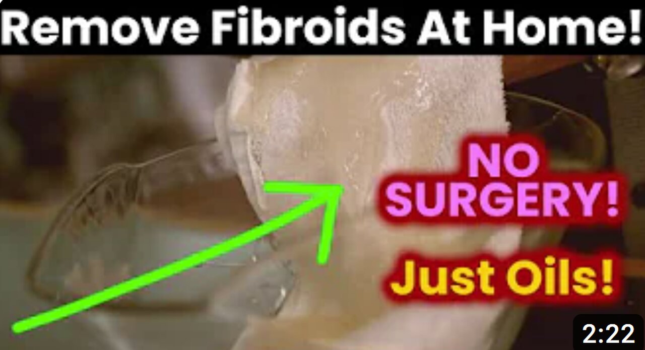 Get rid of FIBROIDS naturally!