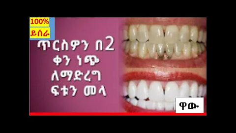 ጥርስዎን በ2 ቀን ነጭ ለማድረግ ፍቱን መላ | Whiten Teeth With Two Days #new_tube