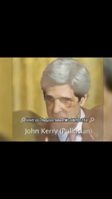 FAMOUS PEOPLE🎭📸👀🌡️ARE SEEN WITH BLACK EYE OR BRUISED EYE🎥👻🐚💫