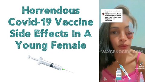 Horrendous Covid-19 Vaccine Side Effects In A Young Female