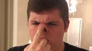 Jovem consegue tocar com o nariz nas sobrancelhas