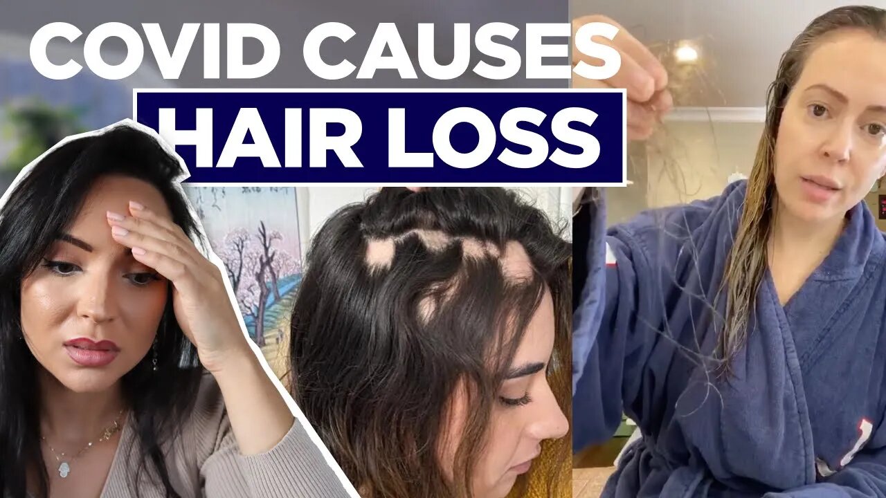 Does COVID Cause Hair Loss? (Alyssa Milano & Khloe Kardashian Talk About Their Experience)