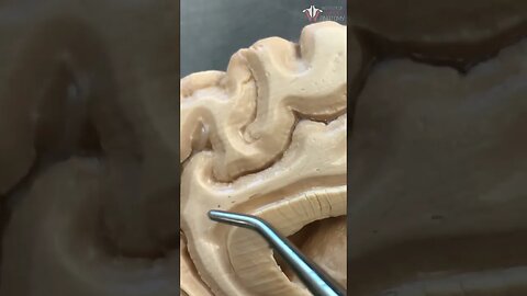 Inside a REAL Human BRAIN