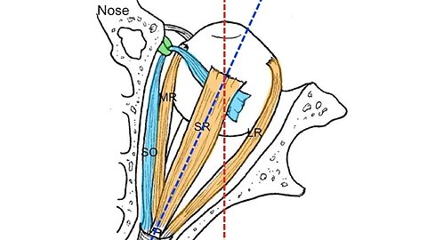 Extraocular muscles tutorial