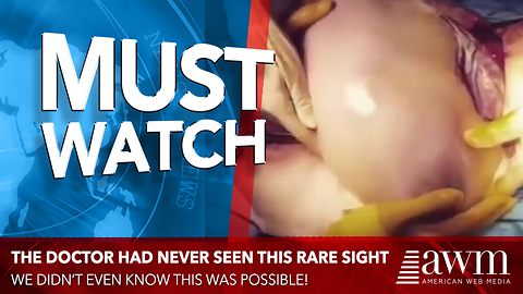 Doctors Know What’s Happening Is Extremely Rare So They Hit Record To Capture It