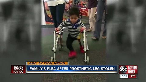 Family's plea after prosthetic leg stolen