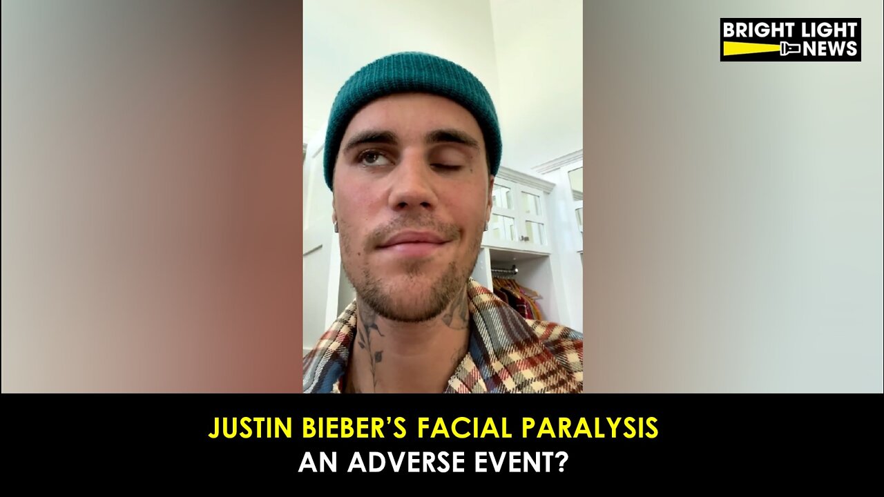 Justin Bieber's Facial Paralysis an Adverse Event?