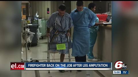 Fishers firefighter back on the jobs after leg amputation