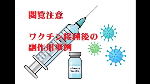 閲覧注意 ワクチン接種後の出産で奇形児