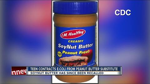 Teen contracts E. coli from peanut butter substitute