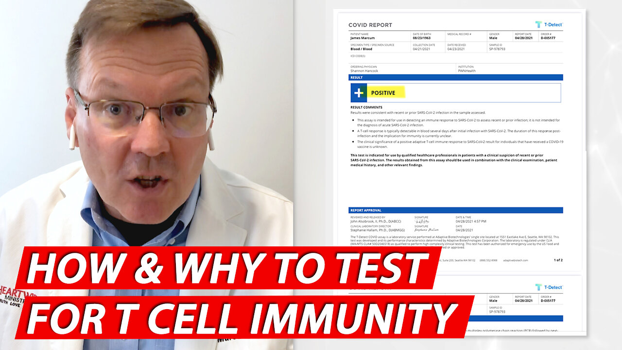 How and why to test for T cell Immunity