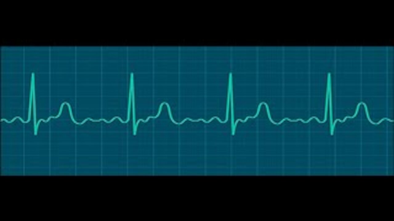 Kolossenzen studie 34a - 3:12-14 1 juli 2021