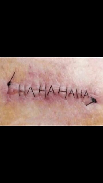 When Routine Weight Loss Surgery Goes Wrong 😑