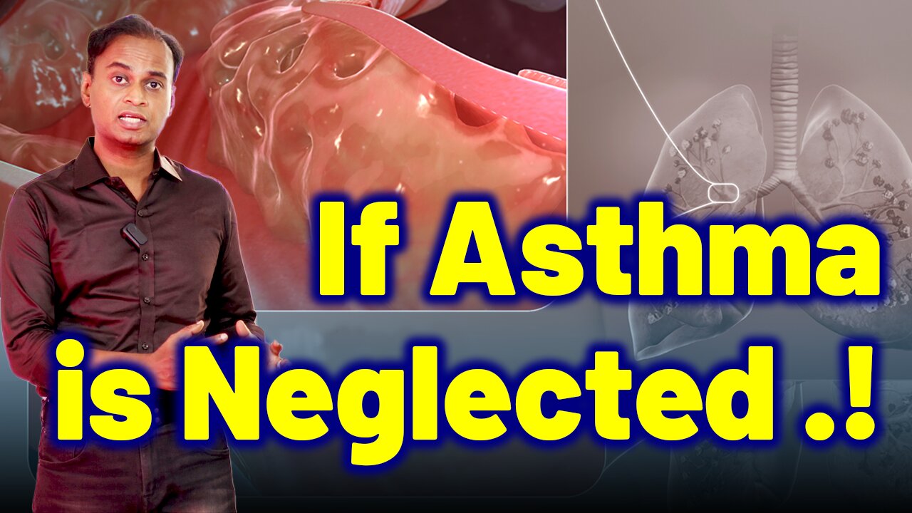 What Happens if You Neglect Asthma - Homeopathy Treatment & Cure | Dr. Bharadwaz | Homeopathy